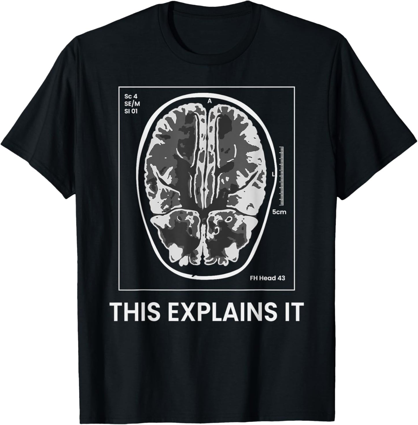 Funny MRI Scan Brain for CRAZY CAT LADY This Explains it T-Shirt