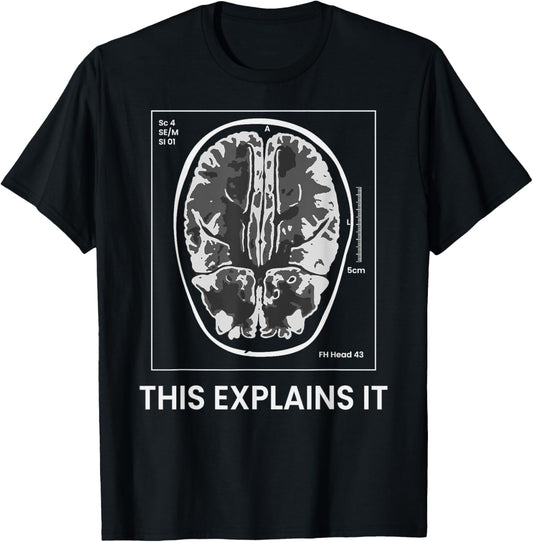Funny MRI Scan Brain for CRAZY CAT LADY This Explains it T-Shirt